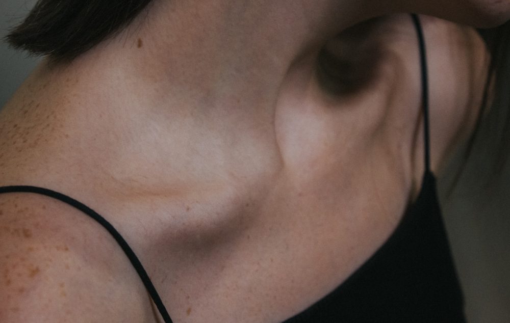 how to prevent neck wrinkles Avoid Tight Clothing and Accessories Around the Neck 1000x634 1 - Understanding the Causes of Neck Wrinkles and Effective Ways to Prevent Them